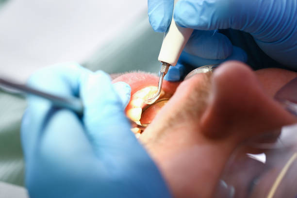 Professional Emergency Dentist in LA