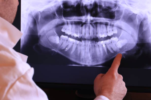 Best Emergency Dental Care for Broken or Chipped Teeth in Grand Point, LA